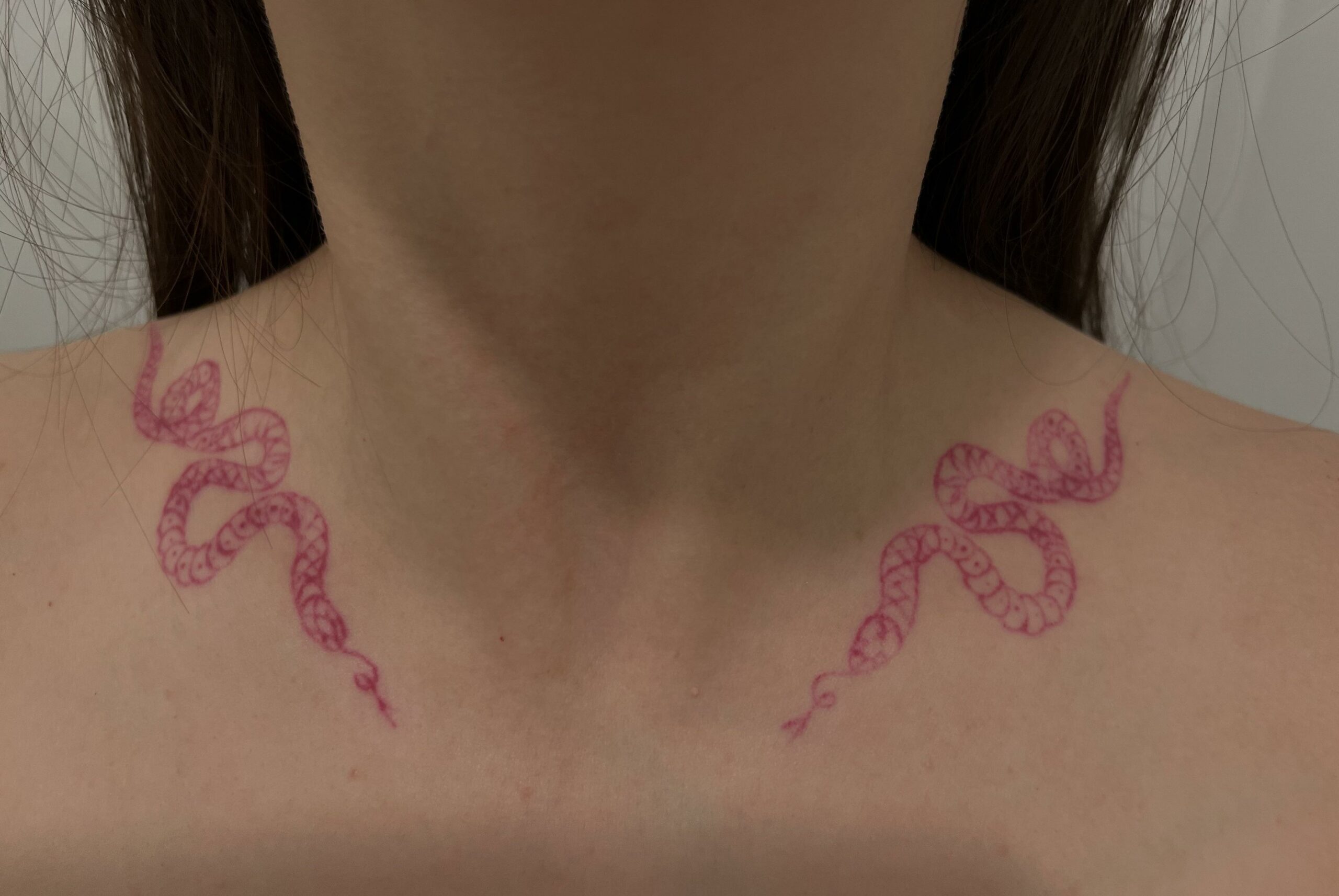 red-ink-tattoo-removal